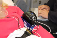 WVSM on patient